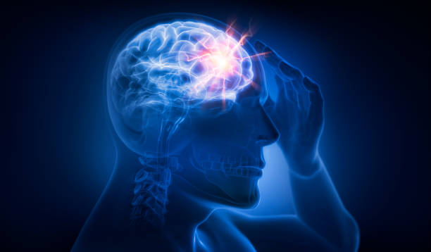 When Does Infant Brain Damage Constitute Medical Malpractice in New York?